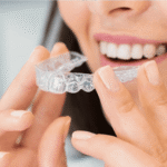 Invisalign Treatment in Palmdale